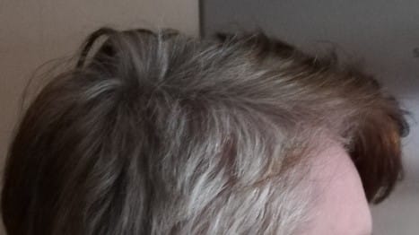 Grau lassen haare rauswachsen Graue Haare